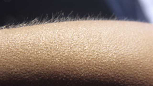 What Are Goosebumps? Why They Happen, According to Experts - Vimarsana News