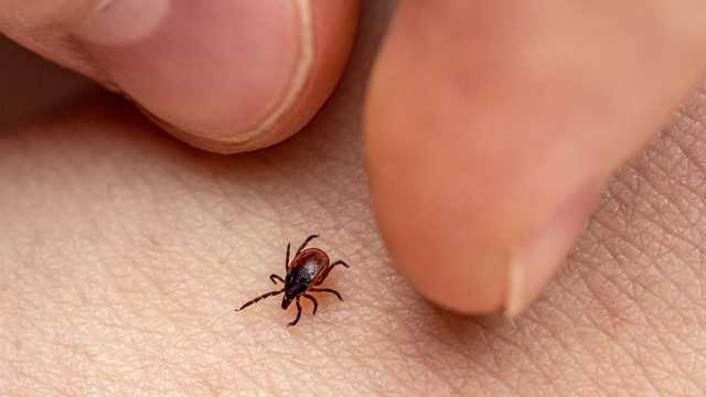 How to Remove a Tick Head Stuck in Your Skin - Tick Head Removal Steps - Vimarsana News