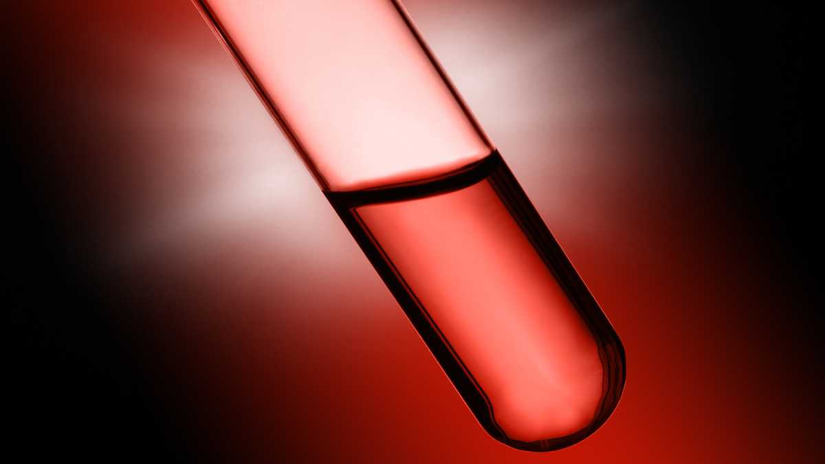 FDA approves a new Alzheimer’s blood test doctors can order