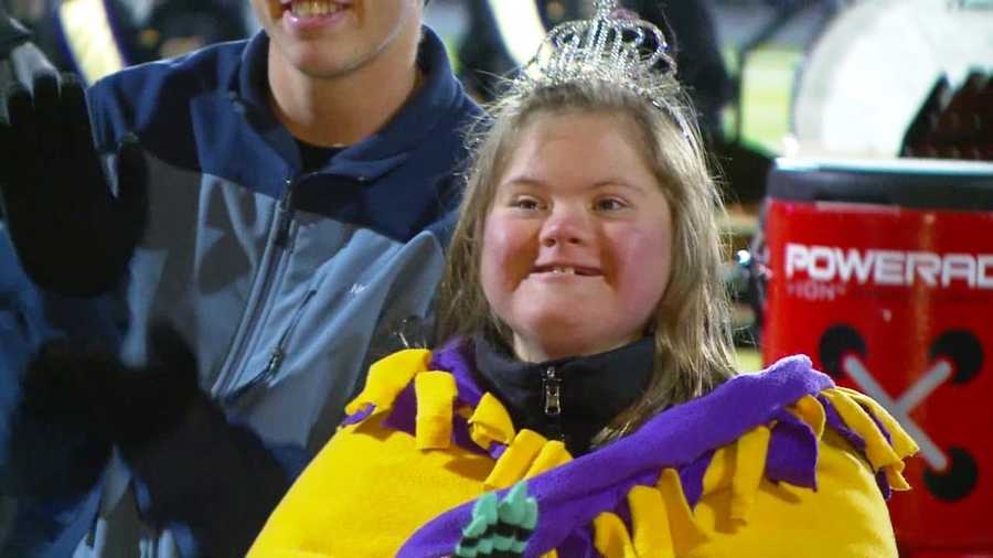 Katie Ball, a Waukee High School student who has Down syndrome, received big cheers at Friday night’s football game when she was introduced to the public as homecoming queen.