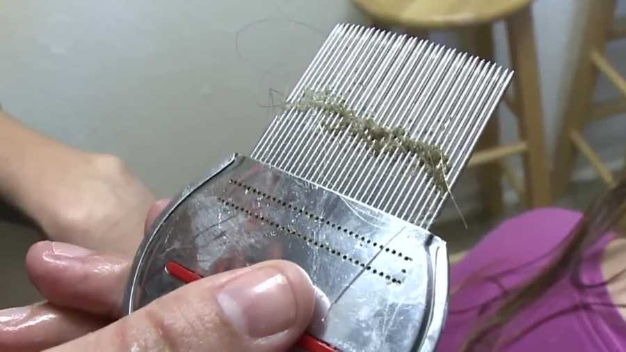 "Super lice" are in Wisconsin, and a new report says they're not responding to over-the-counter drugs.