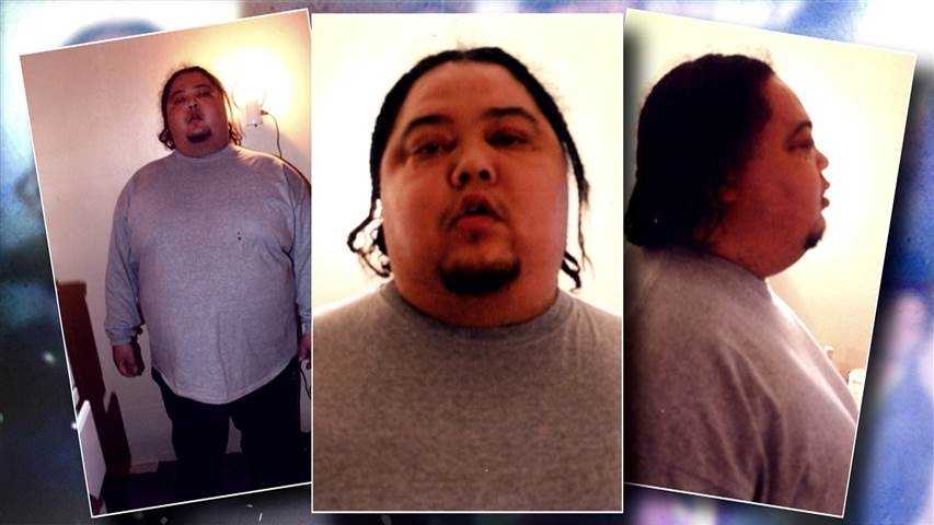 After gaining 120 pounds, rare diagnosis saves man’s life