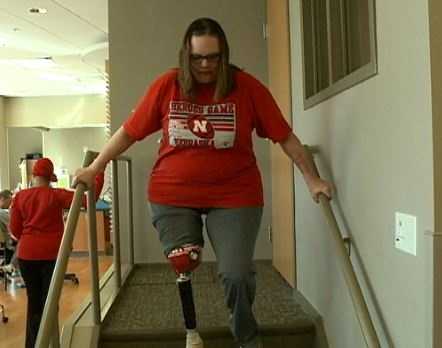 Crash victim takes new step with prosthesis