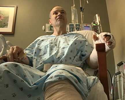 Motorcyclist Survives Crash, Loses Part Of Leg