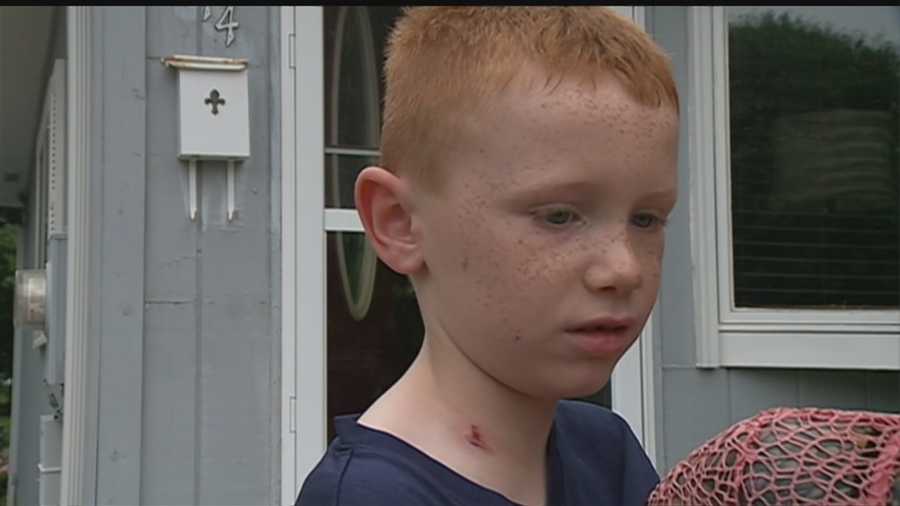 Council Bluffs police say a 7-year-old boy was watching fireworks near 26th Street and Avenue J with his grandparents when he was struck by a bullet.