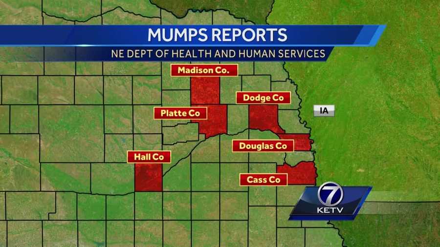 County and state health departments are tracking more than 20 mumps cases across eastern Nebraska and, since it's so contagious, that number could grow.