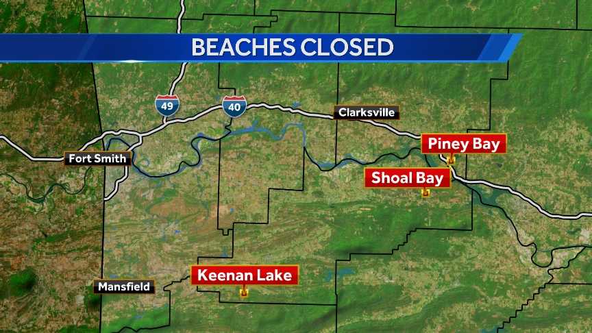 3 Local Beaches Closed Due To E. Coli Threat