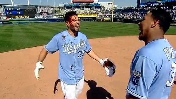 Watch: Is that blood on Eric Hosmer's face? Nope, it's just BBQ sauce