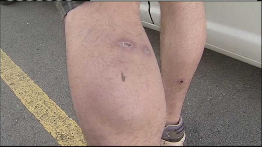 A man who was shot in the leg while driving his car off an Interstate 70 exit said the experience was like getting hit in the legs with a baseball bat. He still has the bullet embedded in his leg.