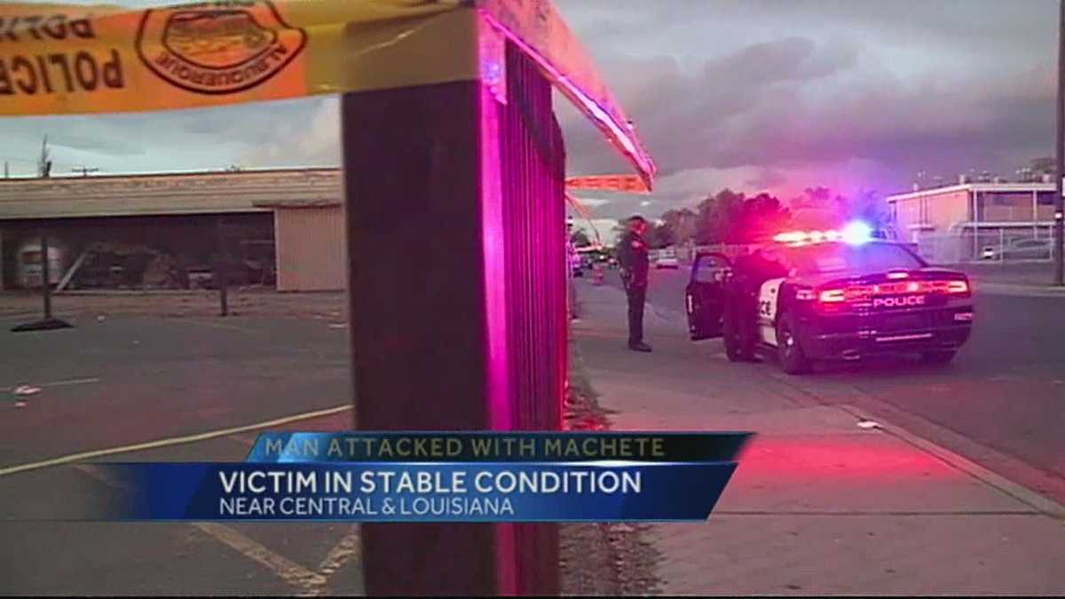 Man expected to survive machete attack