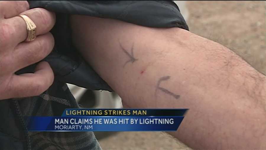 NM man survives close call with lightning bolt