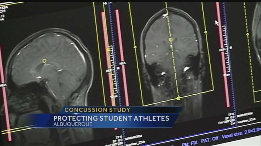 Concussion study: Protecting student athletes