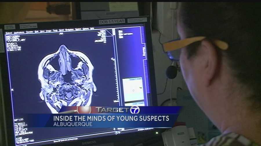 Research into kids who commit murder and the difference in their brain makeup.