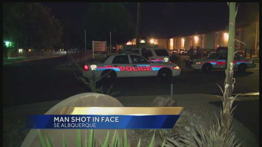 Man Shot In Face Overnight