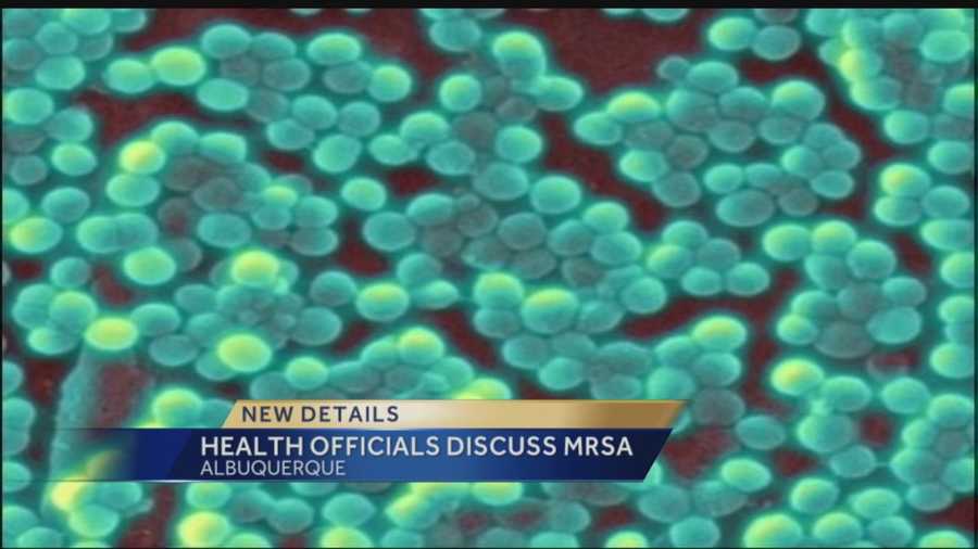 Parents were left in the dark about an infectious disease found at an Albuquerque high school.