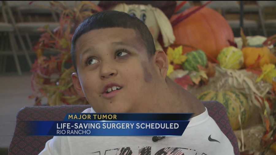 There’s hope for a little boy living with a massive tumor on his body.