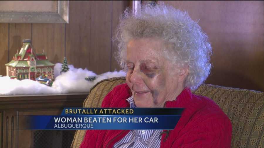 An Albuquerque grandmother was attacked right in front of her home and then police say the suspects took her car for a while ride.