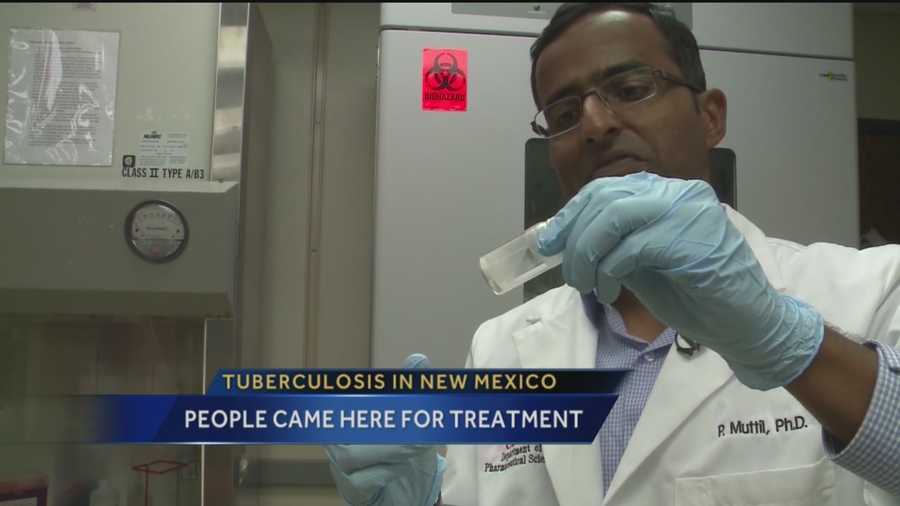 Health officials are tracking down people who may have been exposed to tuberculosis in Clovis County, a disease New Mexico has a long history with.