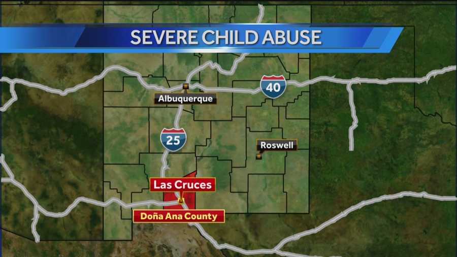 A 3-year-old boy suffered internal and external injuries after police said his mother and her boyfriend abused him.