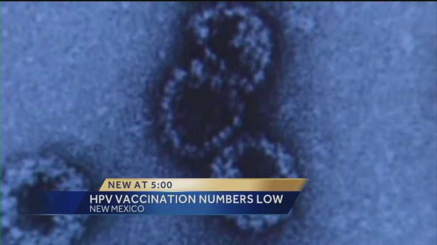 Dr. Barry Ramo says Human Papillomavirus is responsible for 95 percent of cervical cancers.