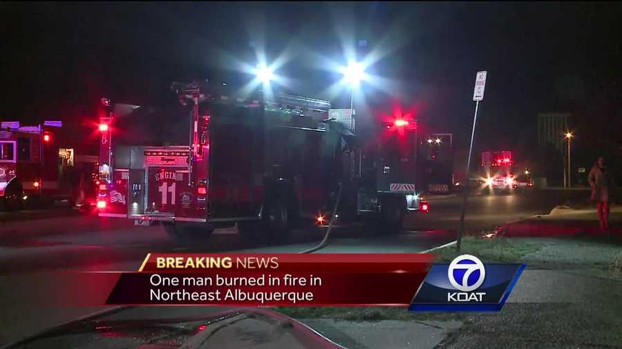 A man is recovering after suffering minor burns in a garage fire in Albuquerque.