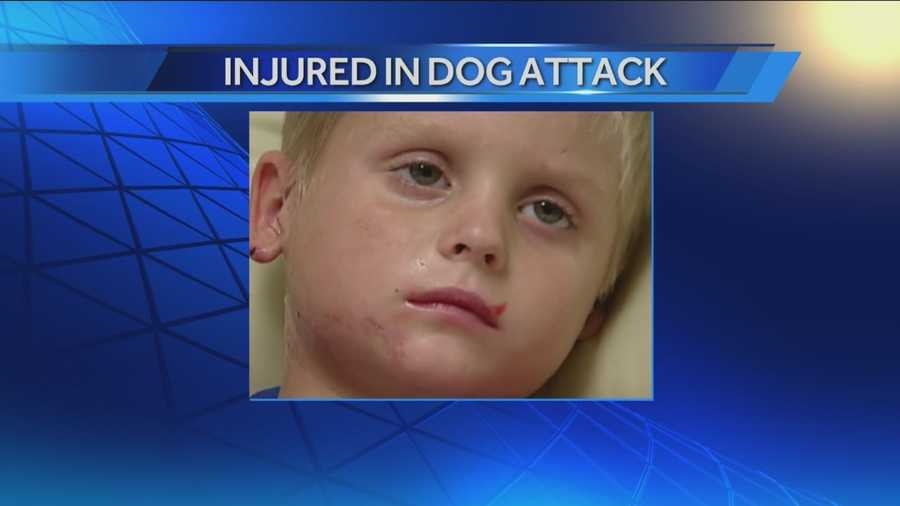 A vicious dog attack in Hollis nearly killed a 4-year-old boy. Now he's recovering at Children's Hospital.