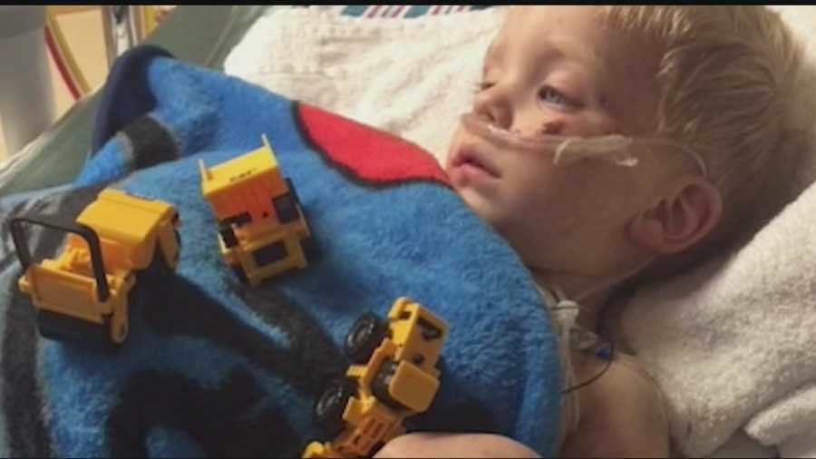 A toddler lost a foot and has several broken bones after an accident with a lawn mower, but he's recovering in the hospital and showing major signs of improvement.