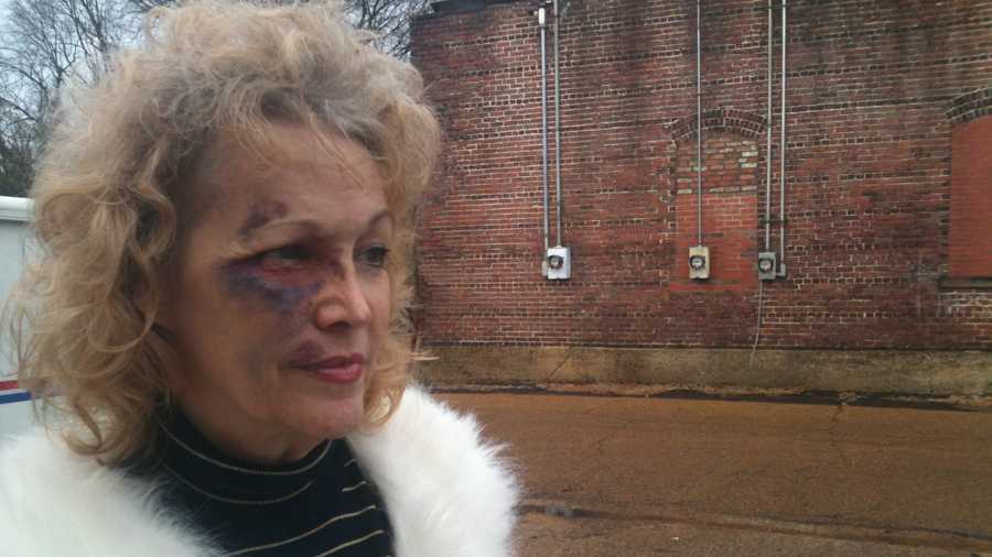 Jackson businesswoman beaten, robbed