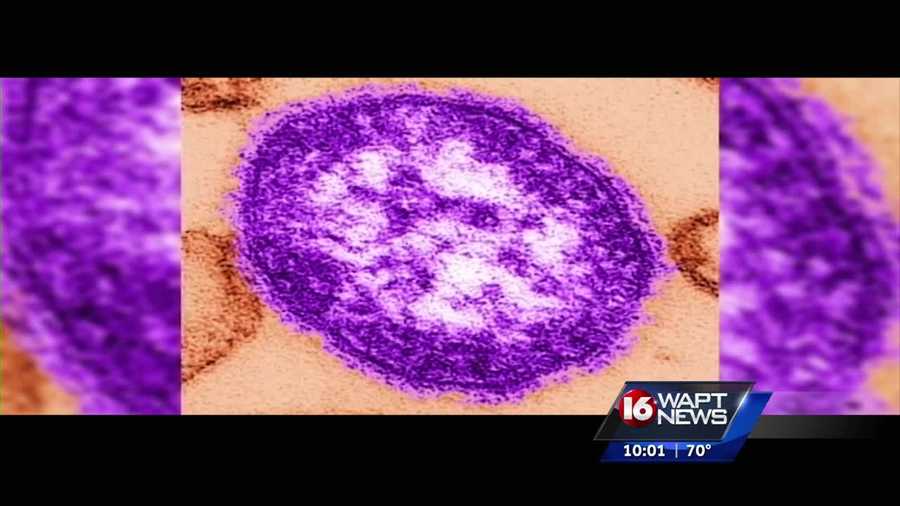 Mississippi is on alert for a measles outbreak.