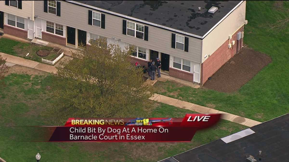 Child mauled by family dog in Essex