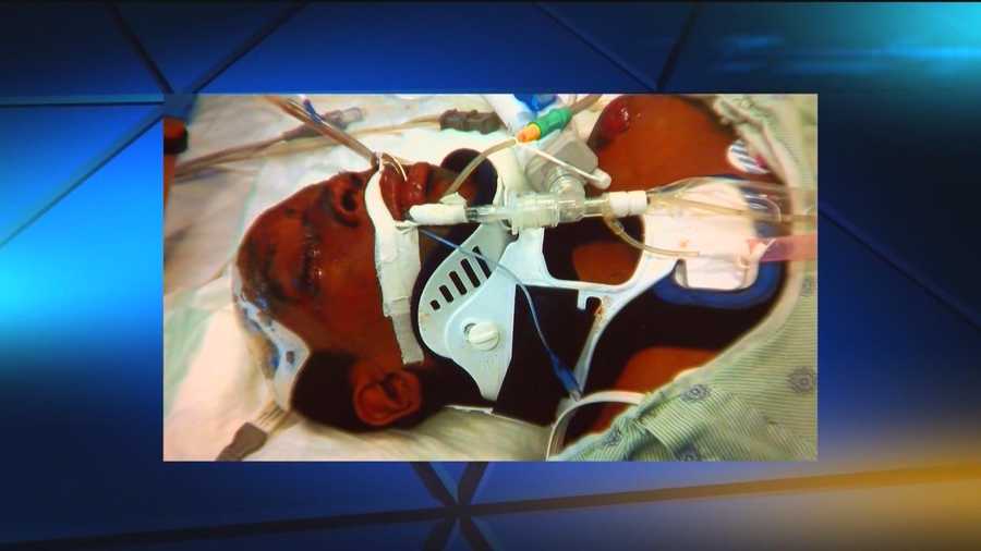 A Baltimore family is suing the Police Department after an officer struck a boy in Hampden.