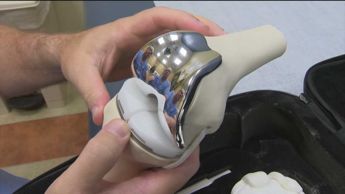 3D imaging utilized in knee replacement surgeries