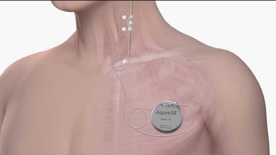 Device gives hope to those suffering from seizures