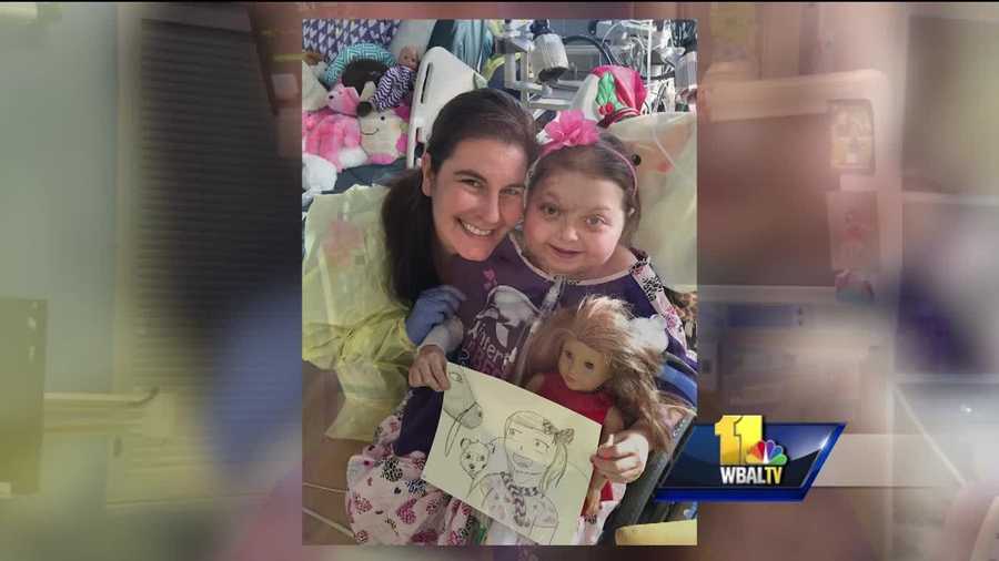 An 8-year-old girl who spent almost two years in the hospital is finally going home. Reese Burdette was badly burned in a fire 22 months ago, but no one had any idea she would be in the hospital that long. Reese suffered burns over 35 percent of her body, and her heart and lungs were so devastated from smoke, the pediatric trauma team at Johns Hopkins Children's Center put Reese on a heart and lung bypass system.