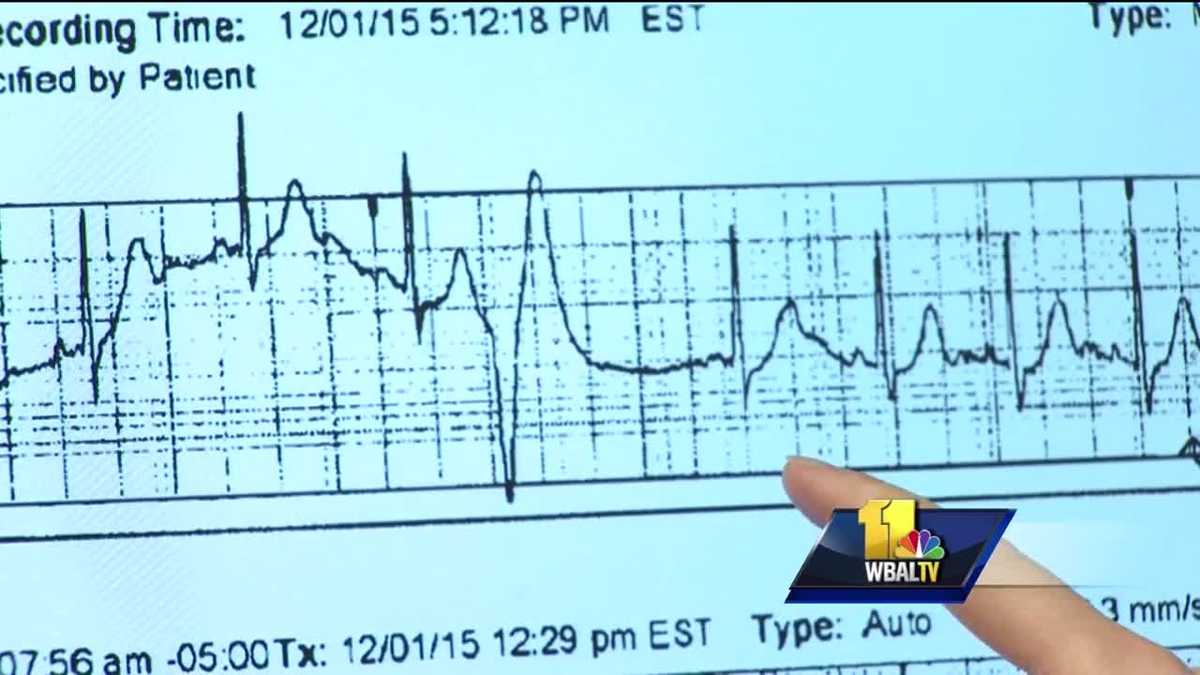 Womans Doctor Understanding Heart Palpitations