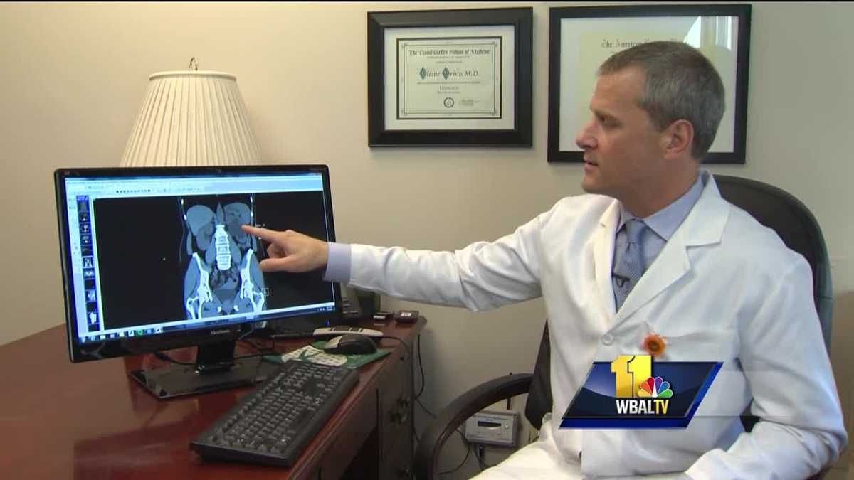 Woman's Doctor Cases of kidney stones on the rise