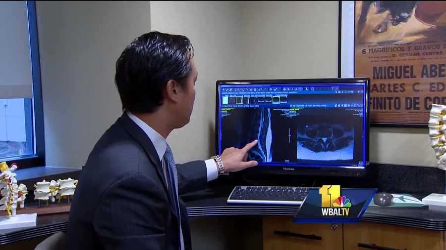 Medical experts say that half the population will experience sciatica. But in some cases, it can be so painful that a person cannot function. Mercy Medical Center Dr. Justin Park said sciatica is caused by a compressed spinal nerve root. He said it is easy to diagnose and very common.
