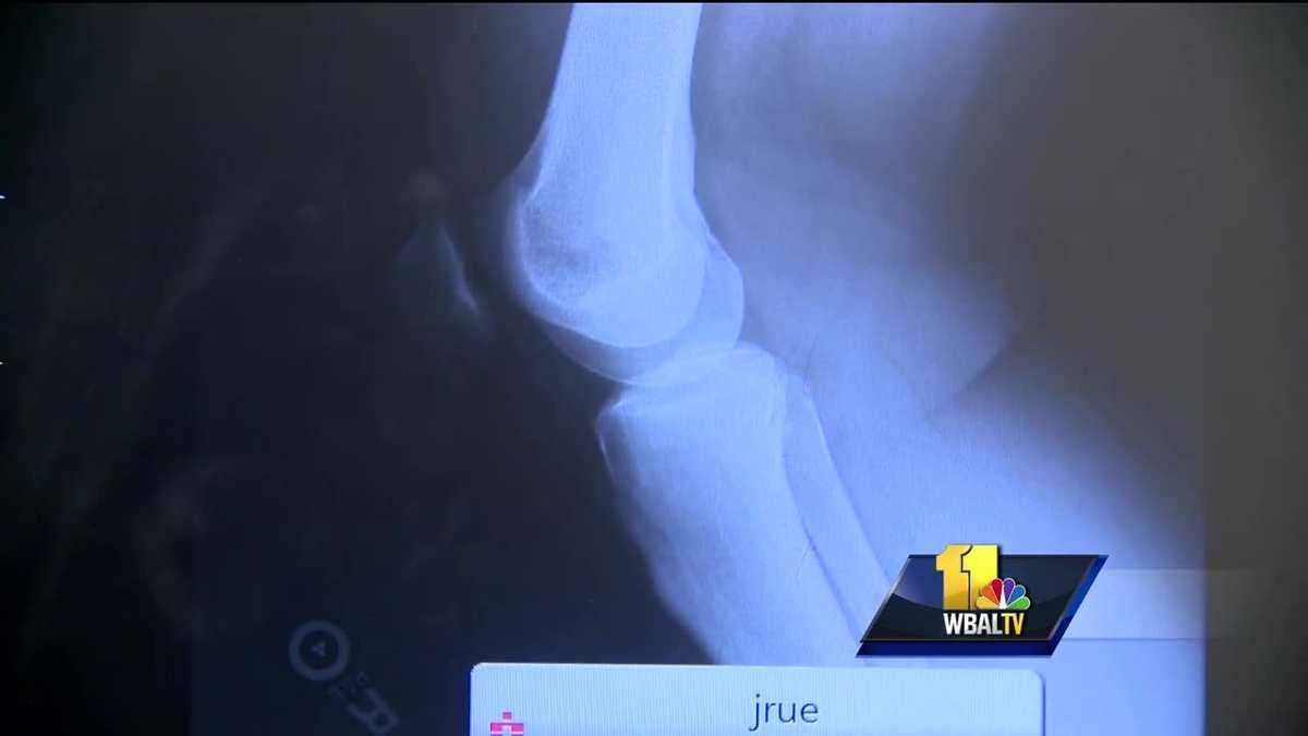 Woman's Doctor Understanding runner's knee