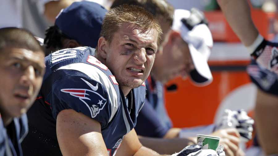 Rob Gronkowski to have surgery, set to miss rest of '16