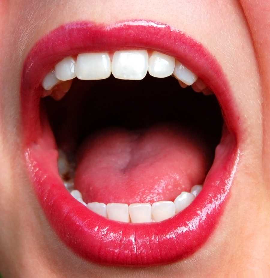 what-your-tongue-says-about-your-health