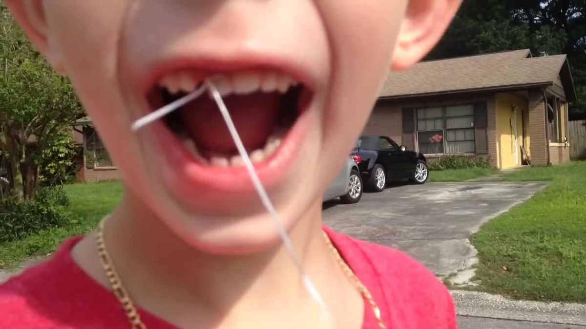 Dad uses Camaro to yank out son's tooth