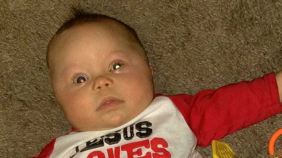 Mom catches infant's cancer with camera flash