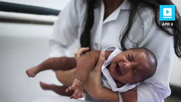 Cdc No Doubt Zika Causes Severe Birth Defects