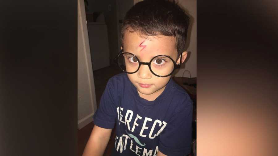 Mom Uses Son S Forehead Cut To Turn Him Into Harry Potter