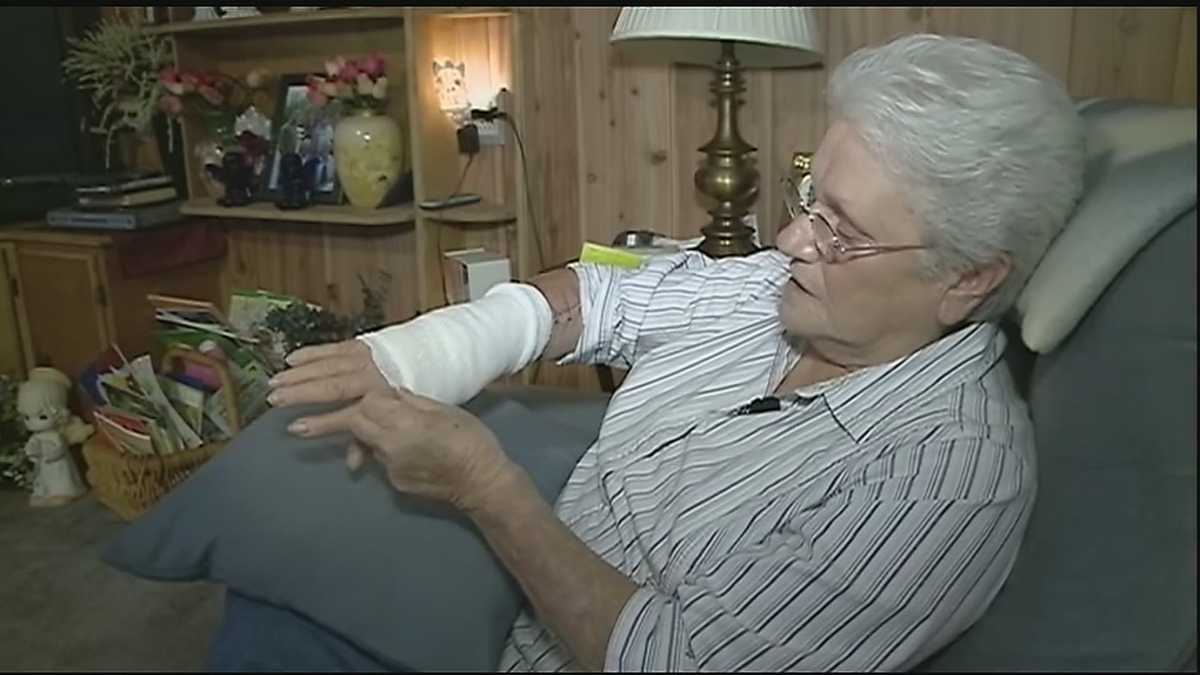 Flesheating bacteria attacks Chauvin woman