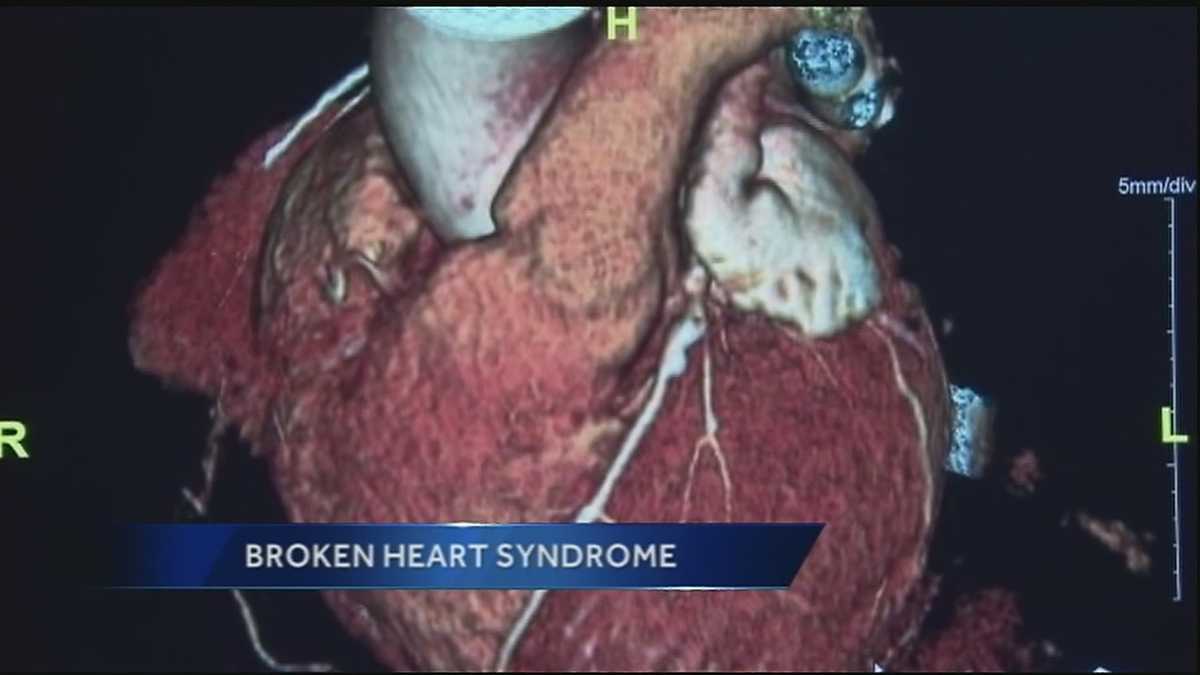 Broken Heart Syndrome