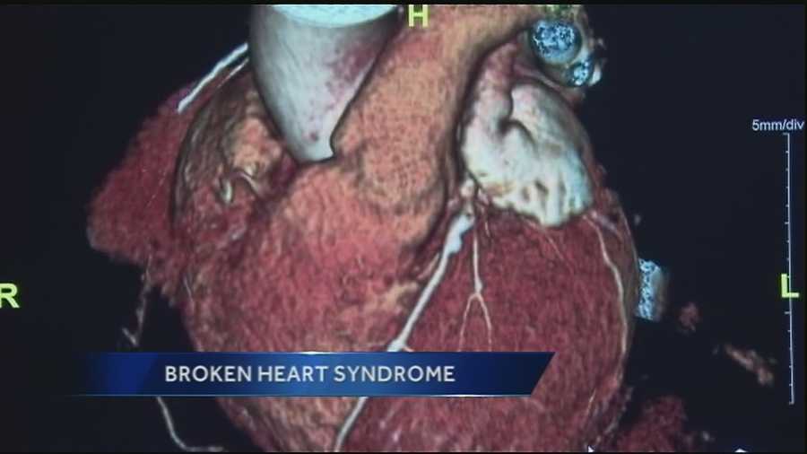 WDSU medical editor Dr. Corey Hebert talks about how symptoms are similar to those of a heart attack.