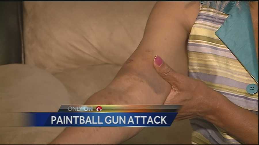 A New Orleans woman said someone shot her with a paintball gun over the weekend.