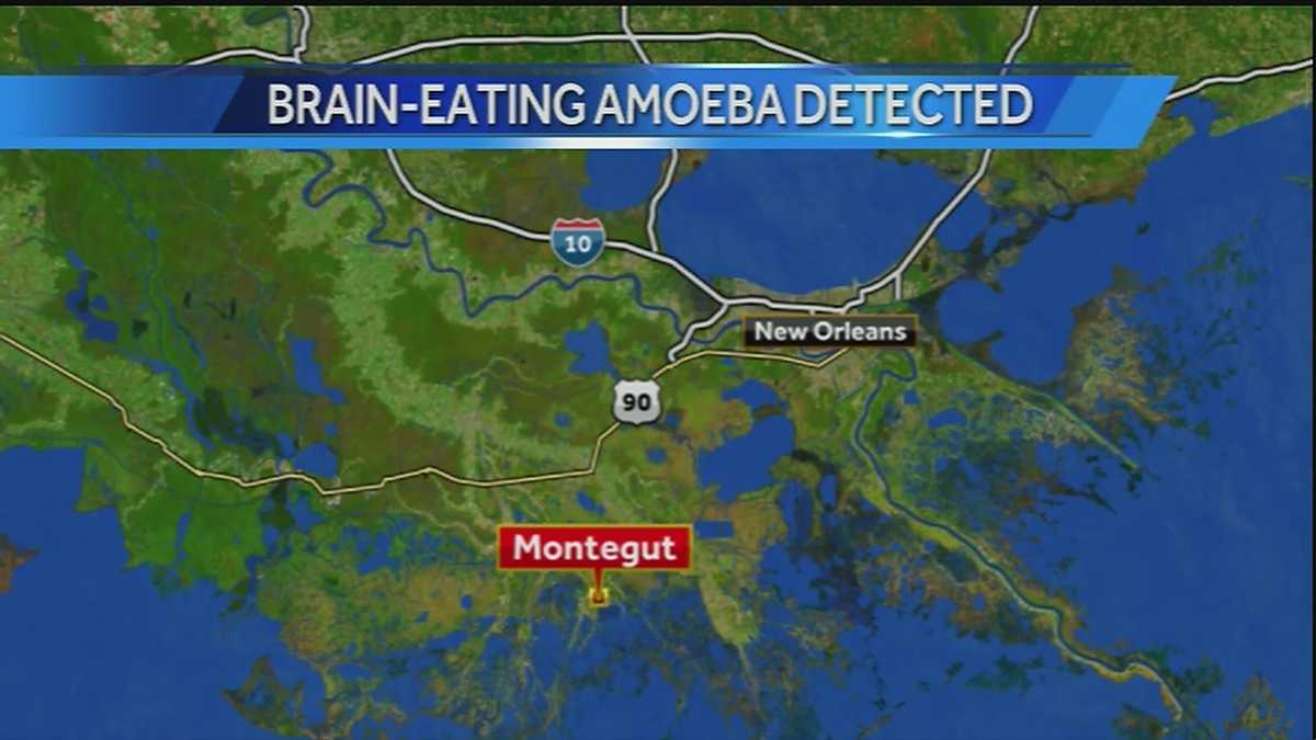 Chlorine burn begins after braineating amoeba found in Terrebonne