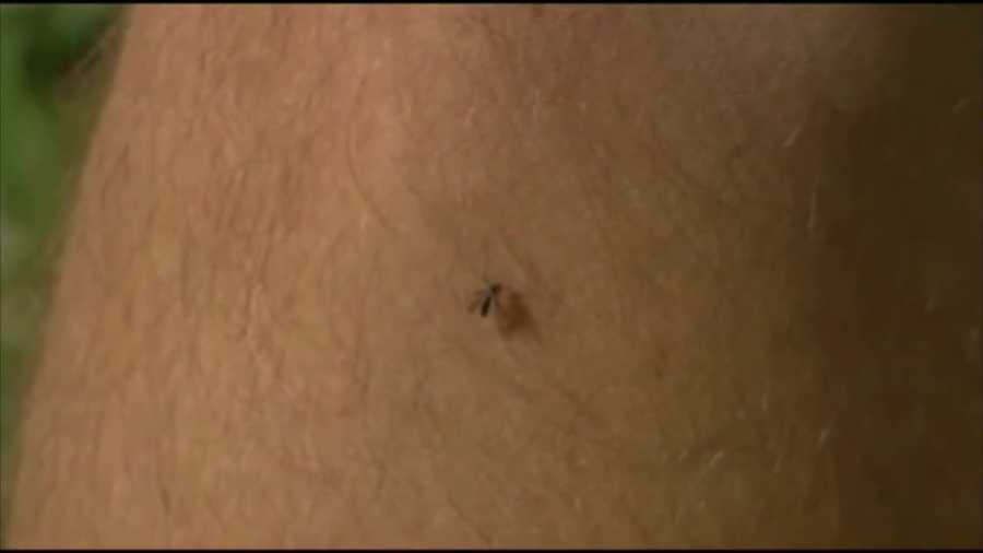 As the Zika virus continues to spread, so do questions about how to prevent the mosquito bites that carry it.